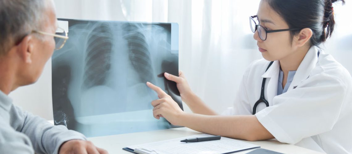 derrame pleural