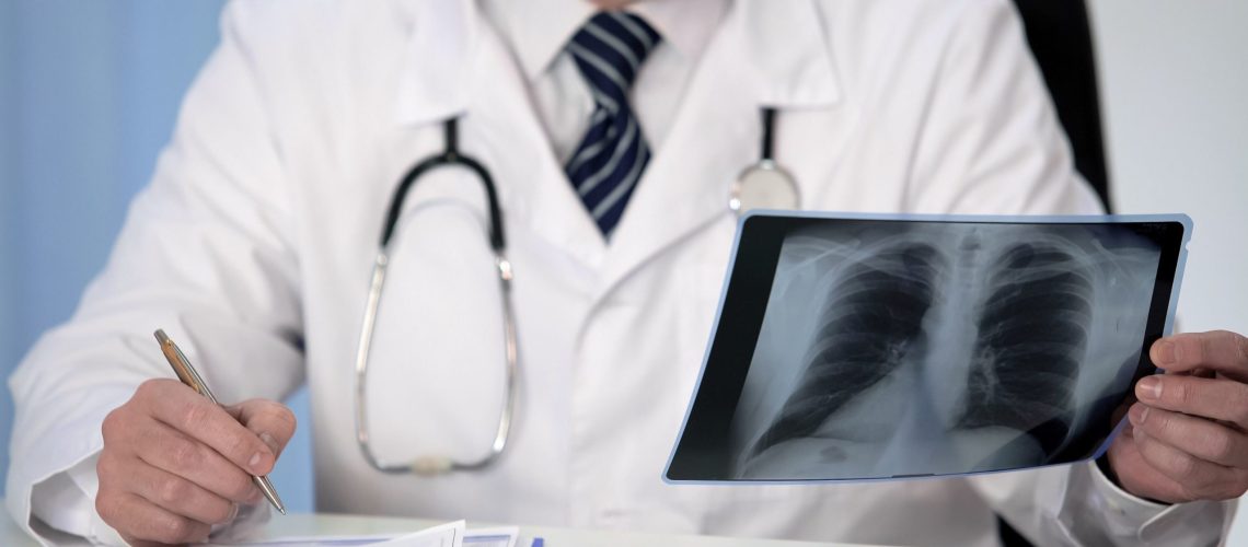 linfoma pulmonar