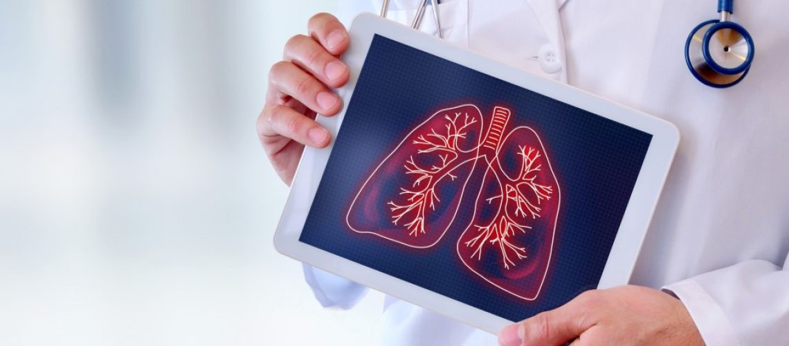 Nódulo Pulmonar