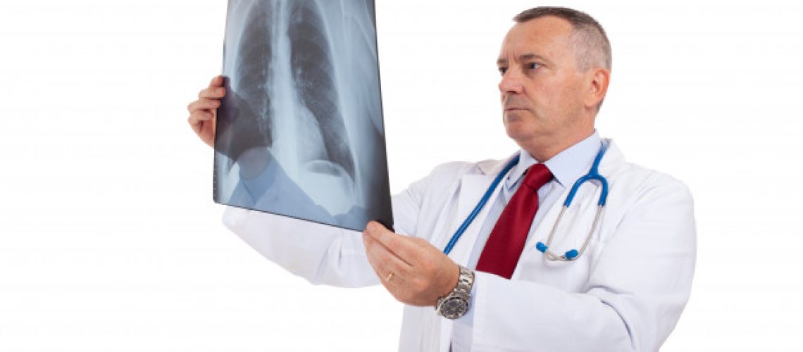nódulos pulmonares